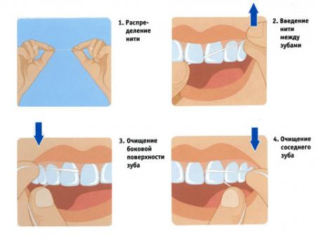 зубная нить как правильно использовать